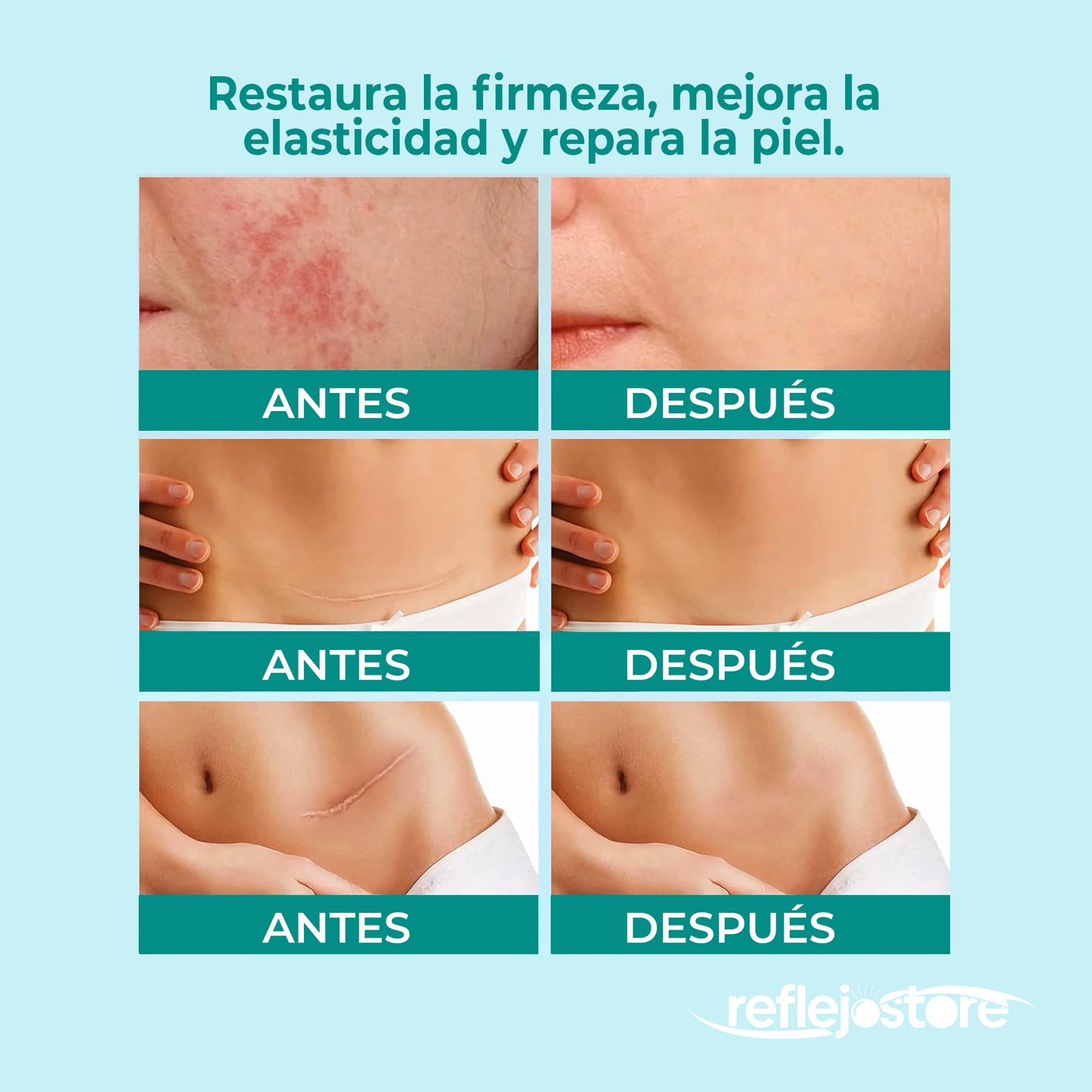 Spray para Cicatrices 30ml