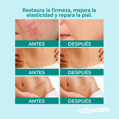 Spray para Cicatrices 30ml